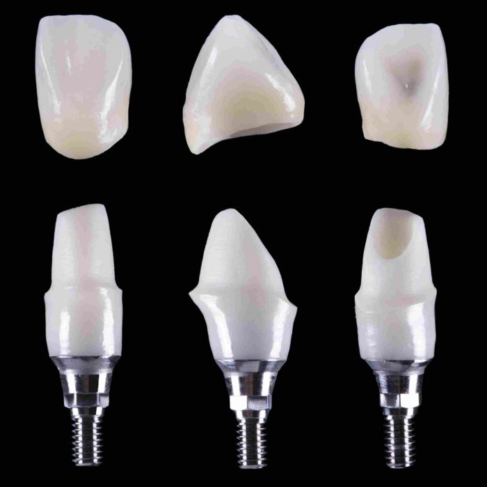 Bruxzir esthetic zirconia crowns crown dental